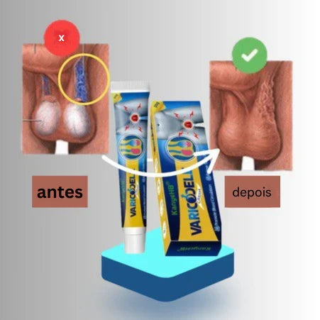Crema natural para tratar el varicocele